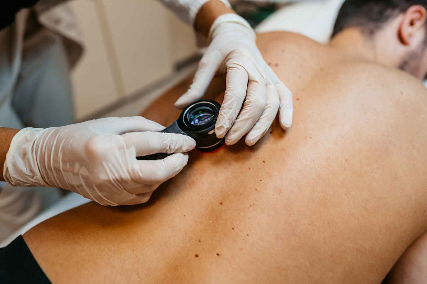 Melanoma Study Day
