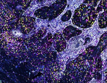 An image of cancer cells from a scan.