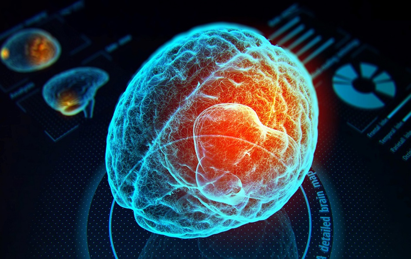 A graphic of a detailed brain in the foreground with several smaller brain out of focus in the background.