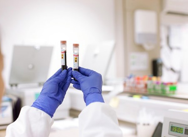 The lymphoma service at The Christie