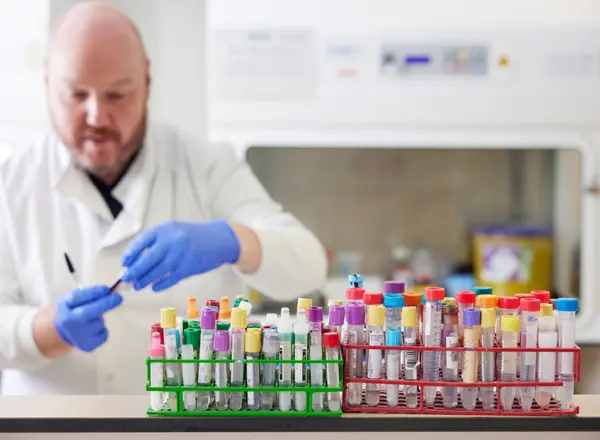 test tube, samples, clinical research, laboratory, associate senior lab technician, Ian Anderson