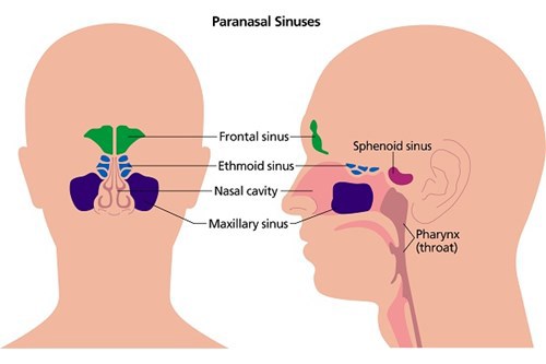 This is a diagram showing the Paranasal Sinuses, shown from the front and  from the side. This includes the frontal sinus, the ethmoid sinus, the nasal cavity, the maxillary sinus, the sphenoid sinus and the pharynx or throat.