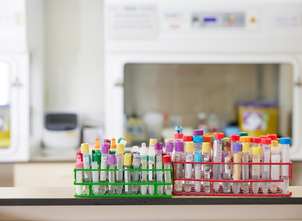 test tube, samples, clinical research, laboratory