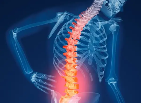 Osteoporosis