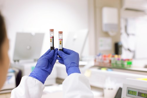Blood test to detect cancer returning reaches final trial stage