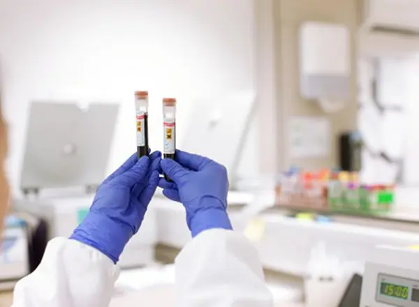 Blood test to detect cancer returning reaches final trial stage