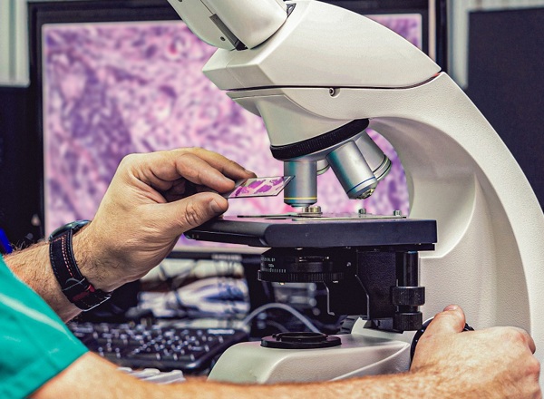 A photo of a microscope with a slide about to be put underneath it; the slide contains several purple blobs.