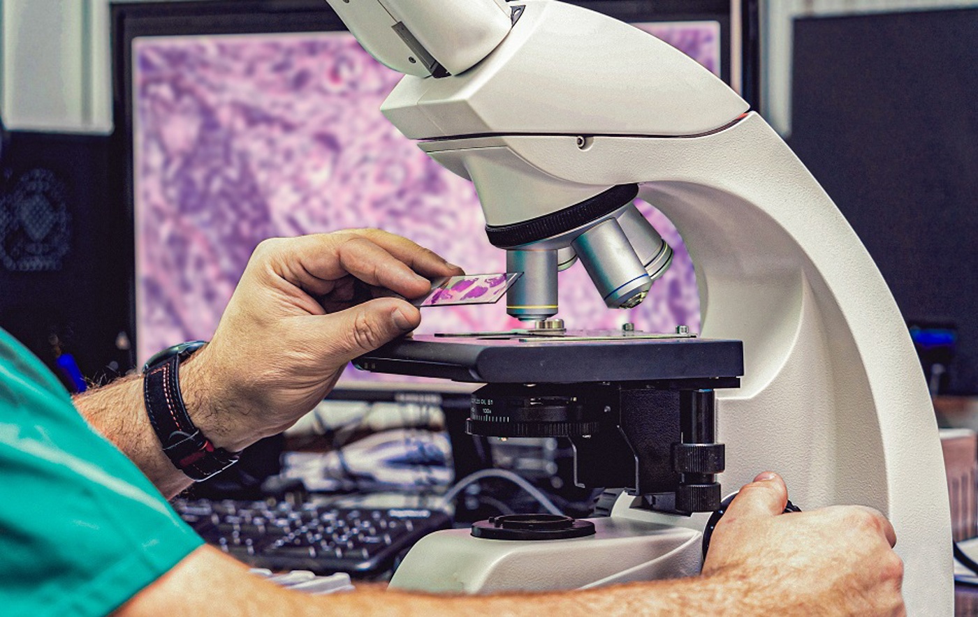 A photo of a microscope with a slide about to be put underneath it; the slide contains several purple blobs.