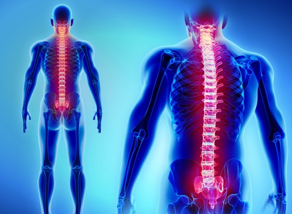Metastatic Spinal Cord Compression (MSCC) Study Day: On-Demand