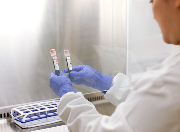 blood, test tube, samples, clinical research