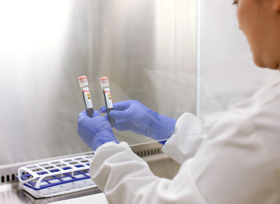 blood, test tube, samples, clinical research