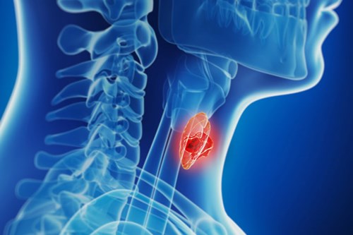 Thyroid Disorders