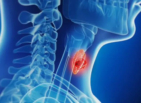 Thyroid Disorders