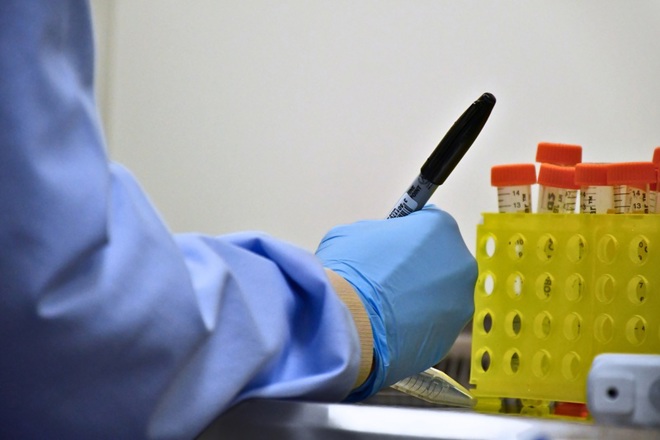 Gloved hand writing with a pen blue lab coat
