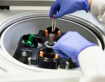 blood, test tube, samples, clinical research, cyclotron, laboratory