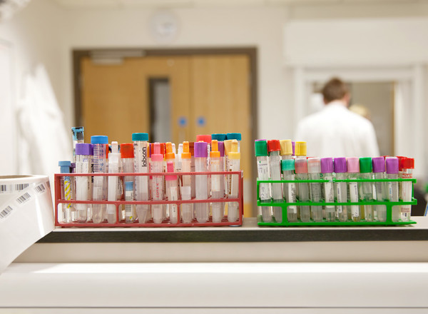 test tube, samples, clinical research, laboratory